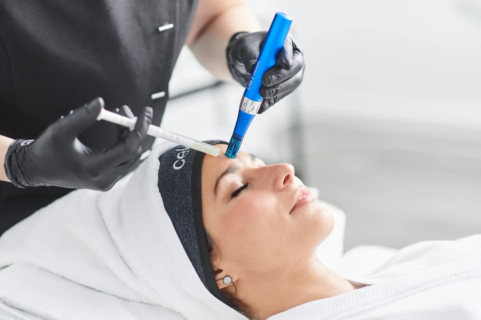 Vrouw die een microneedling behandeling krijgt op haar gezicht