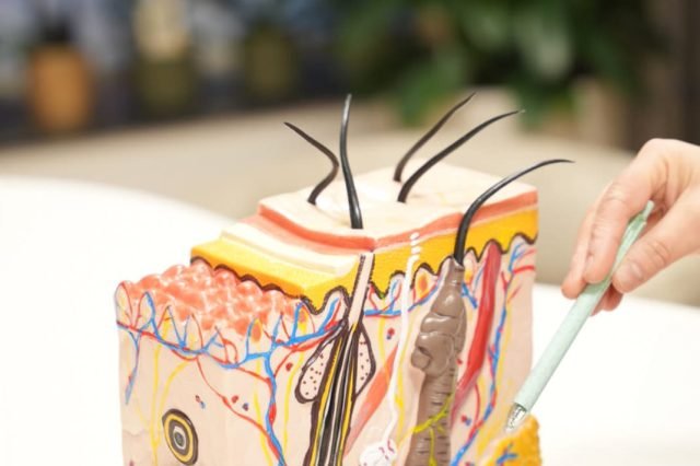 Laserontharing Laserontharing