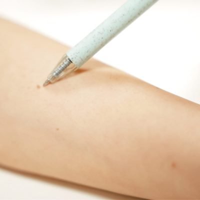 Pigmentatie Pigmentatie