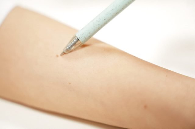 Pigmentatie Pigmentatie